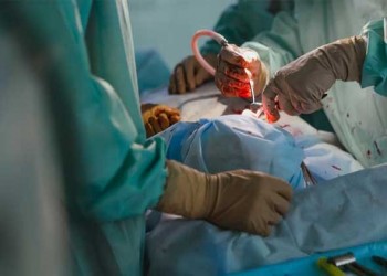 المغرب اليوم - علماء يبتكرُون جهاز ليزر لخياطة الجروح دون نزف دم