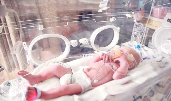 المغرب اليوم - اختبار دم يُحدد سبب إصابة الدماغ عند الأطفال حديثي الولادة
