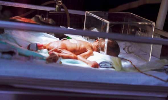 المغرب اليوم - بريطانيا تشهد ولادة أول طفل يحمل حمضًا نوويًا من 3 أشخاص