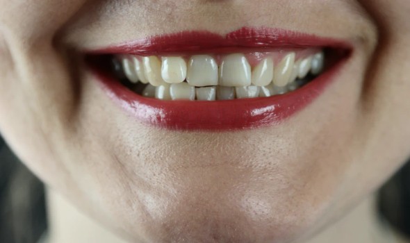 الكشف عن دواء ثوري يمكنه إعادة نمو أسنان الإنسان من جديد