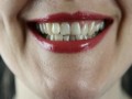 المغرب اليوم - نصائح لتخفيف حساسية الأسنان