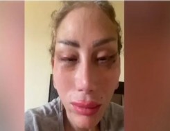المغرب اليوم - الإعلامية ريهام سعيد تكشف عن تشوه وجهها على يد طبيب تجميل شهير